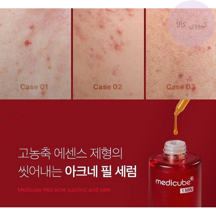 سرم 1 مین مدی کیوب