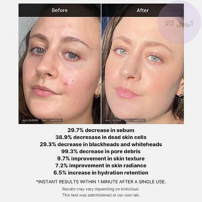 آزمایش های انجام شده بر روی سرم پیلینگ مدی کیوب